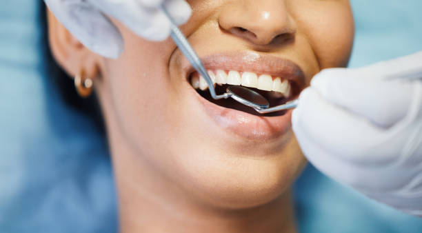 Best Emergency Cosmetic Dentistry (e.g., broken veneers) in San Francisco, CA